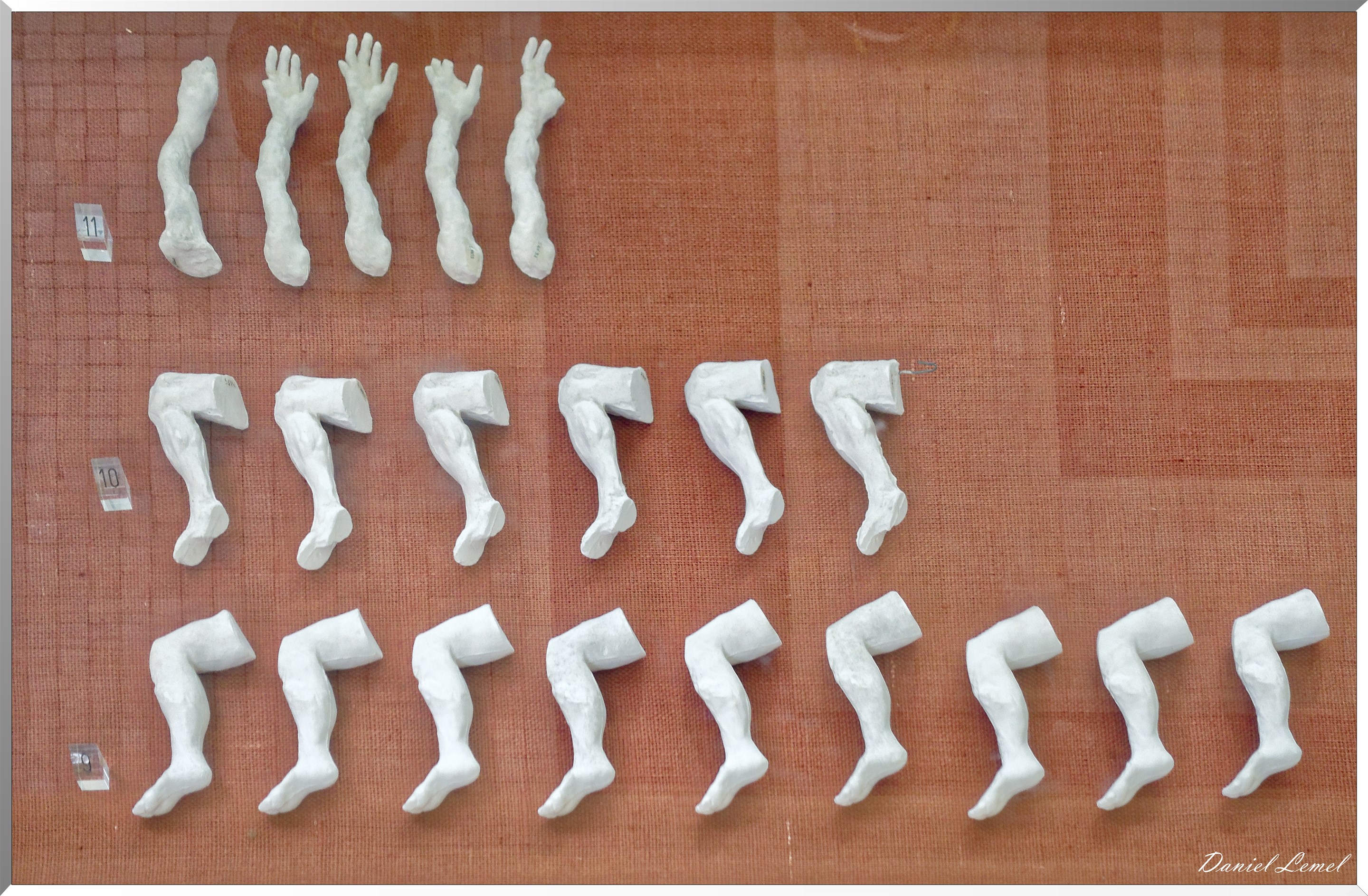 Bras droits, Jambes droites pliées